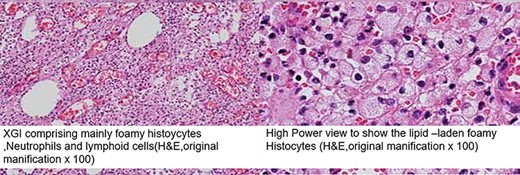 Histological findings