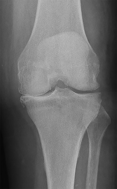 Preoperative radiography.