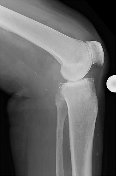 Preoperative radiography.