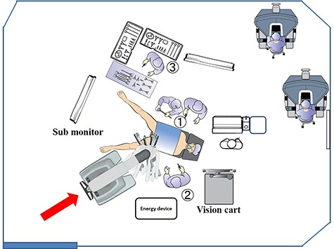 In the surgery and urology departments, the operating room was arranged so that the operation could be performed smoothly and without waste by moving the monitor.