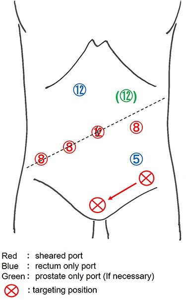 In the surgery and urology departments, as many ports as possible were shared so that they could be shared and utilized.