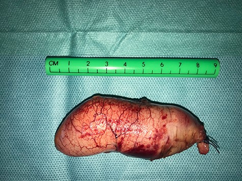 Case 1: specimen.