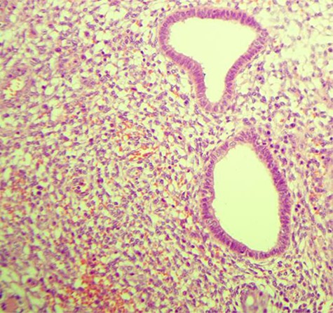 Endometrial glands surrounded by stroma (HE, ×200).