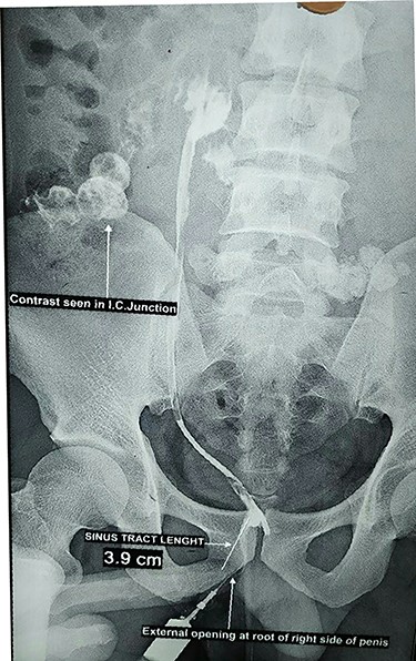 Sinogram