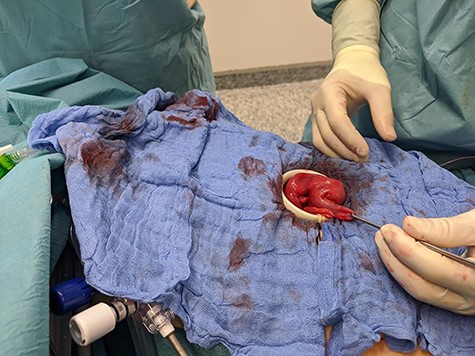 Multipurpose using of the single port.