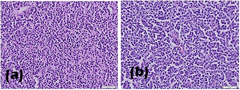 Histopathological results of (a) left and (b) right testicle biopsy.