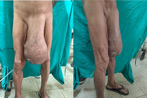 At the time of presentation.