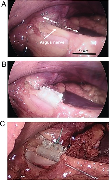 Vagus nerve cuff electrode placements. (A) Ventral vagus nerve trunk. (B) Placement of the cuff electrode. (C) Cuff electrodes with a suture to keep tabs closed. Bar = approximate scale with greater accuracy in the foreground.