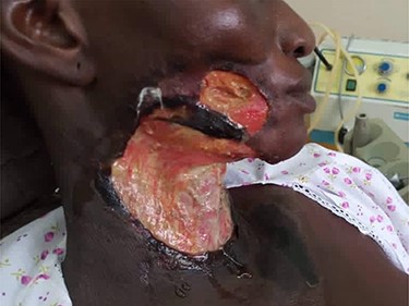 Right lateral facial view.