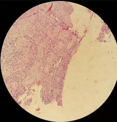 Case 1, Histopathological examination of the patient.