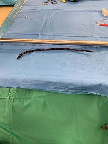 The 25-cm tree branch following removal.