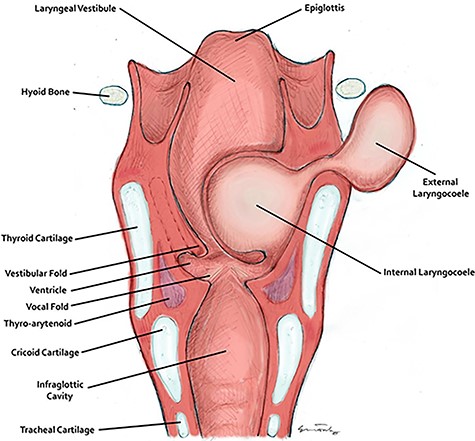 The anatomy of the larynx and development of a laryngocoele. This figure was drawn and provided by Mr. Mel Corbett.