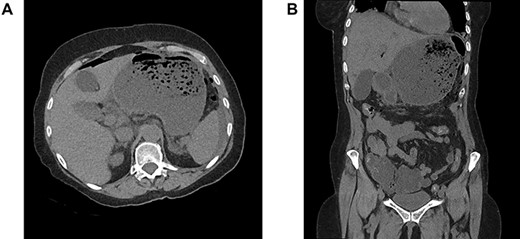 Computed tomography scanner.