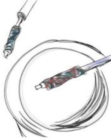 This action cores out the entire tract from external to internal opening. The rod when pushed forth displays the tract, the integrity of which is checked.