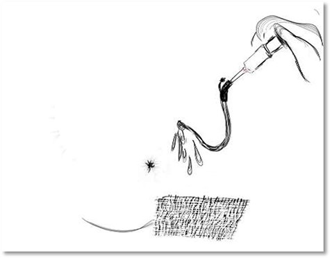 An infant feeding tube is used to flush the tract to remove clots and debris if any and this must be used for flushing daily to facilitate healing from inside-out.