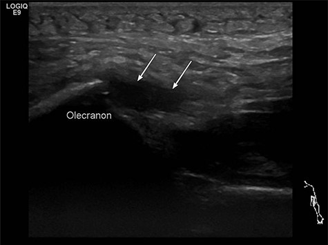 Preoperative ultrasound diagnostic.