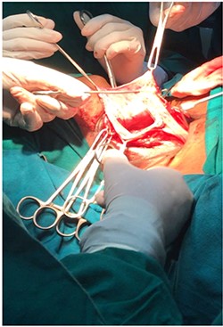 Image showing approach to the mass.