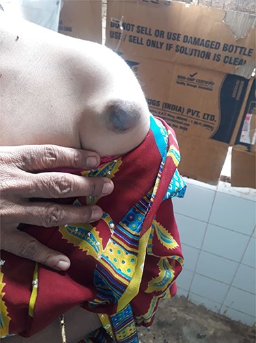 Preoperative image of the lesion.
