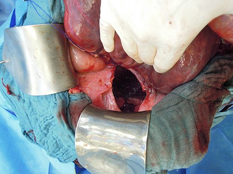 Partial direct closure.