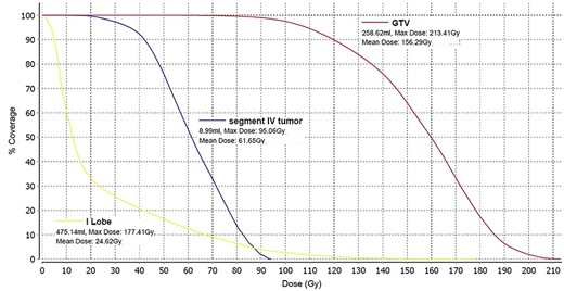 Dose–volume histogram of the main lesion (GTV) localized in the right liver lobe (red), the dose to the Segment IVA lesion (blue) and the dose to the left liver lobe (yellow).