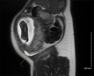 MRI pelvis, sagittal view.