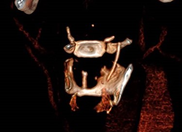 3D reconstruction.