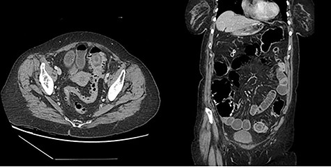 Representative cuts of Patient 1 CT scan.