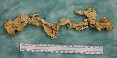 Crumpled surgical glove.