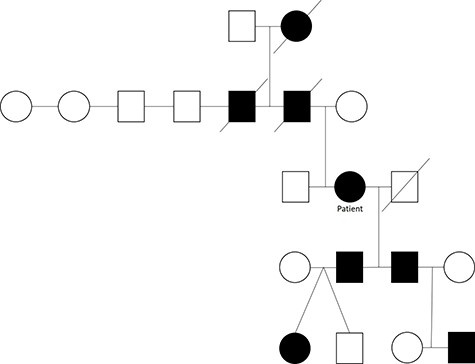 A pedigree of a family with HHT a rare autosomal dominant genetic disorder that leads to abnormal blood vessel formation in the skin, mucous membranes as well as the lungs, liver and brain.