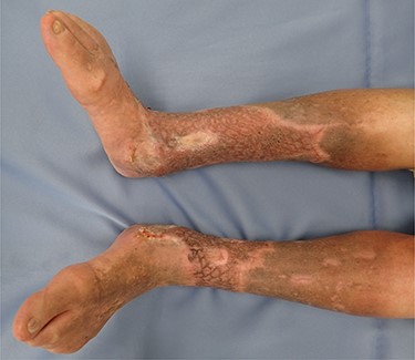 Postoperative 2 months.