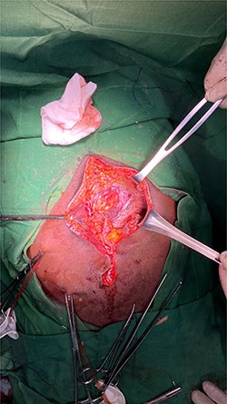 Obvious facial defect during repair