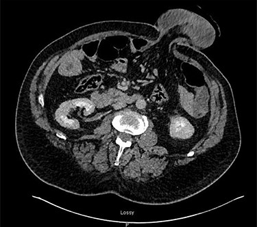 CT-scan.