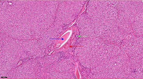 Haematoxylin and eosin staining section showing a portal tract containing a portal vein (blue arrow), hepatic artery (red arrow) and a bile duct (green arrow).