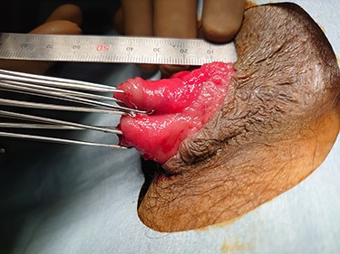 Side view of CMP after ISR