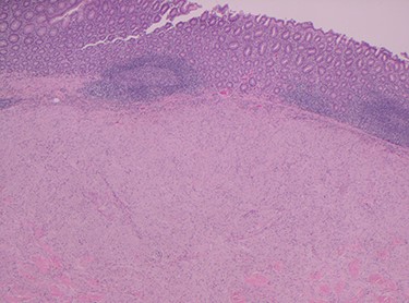 H&E stain magnification × 2.