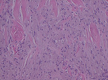 H&E stain magnification × 4.