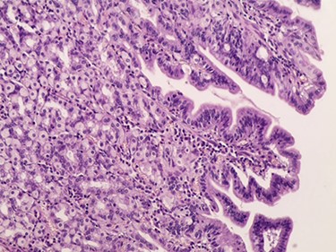 Microscopic image.