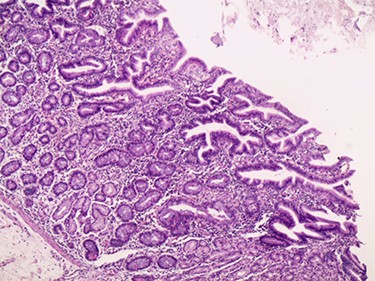 Microscopic image.
