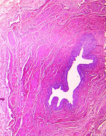 The lumen of the ureter covered by transitional epithelium.