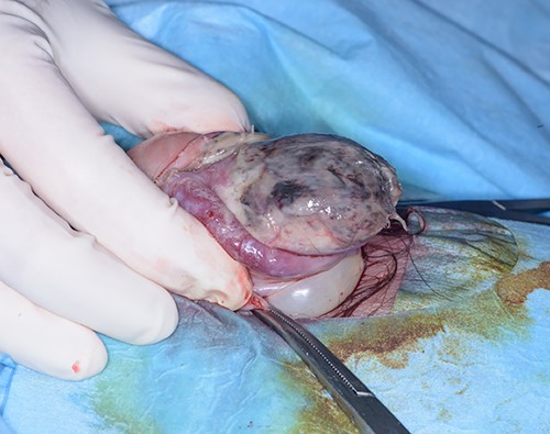 Intra-operative photo after dorsal slit procedure showing ischaemic patches on the glans of the penis.