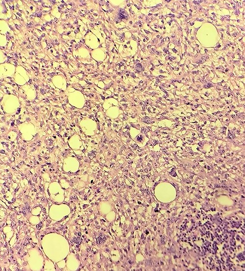 Histopathology of the mass.