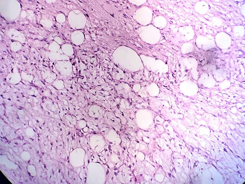 Histopathology of the mass.
