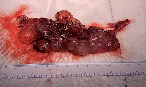 MCPM specimen.