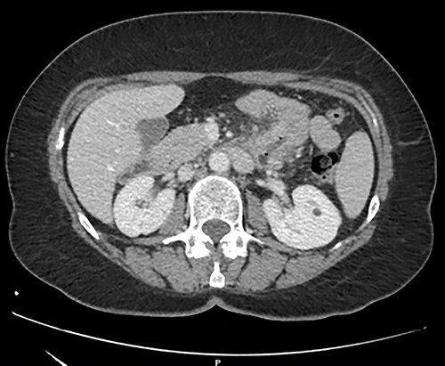 Contrast-enhanced CT scan.