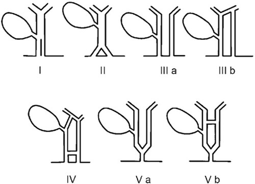 Duplicated CBD classification developed by Researchers E. Choi, J.H. Byun, D. Park et al. (2007). Type IIIa – Type Vb variants have duplicated CHD and CBD ducts with Type V duplications the rarest.