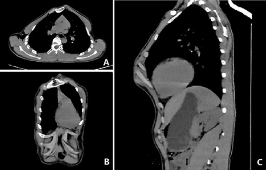 CT examination images before operation.