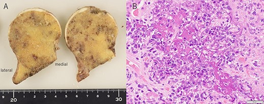 Cross section of the sliced femoral head (A) and histological findings of hematoxylin and eosin staining (B).
