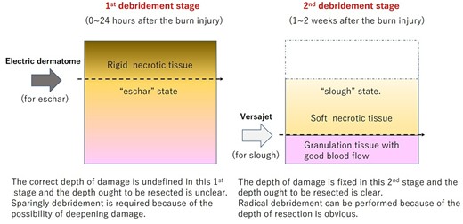 The schema of the concept of a stylized two-stage debridement strategy using an electric dermatome and a Versajet™ hydrosurgery system.