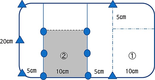 30 × 20 cm mesh was cut into 20 × 20 cm, and the remaining 10 × 10 cm part (①) was turned over and adjusted so that the collagen film (②); the corners of the mesh were fixed 3-0 nylon (triangle) for traction, and the folds in two with collagen film were fixed 3-0 VICRYL™ (circle).