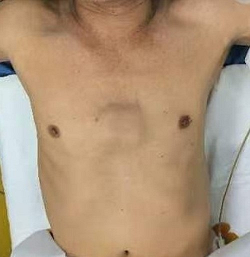 Location of tumor.